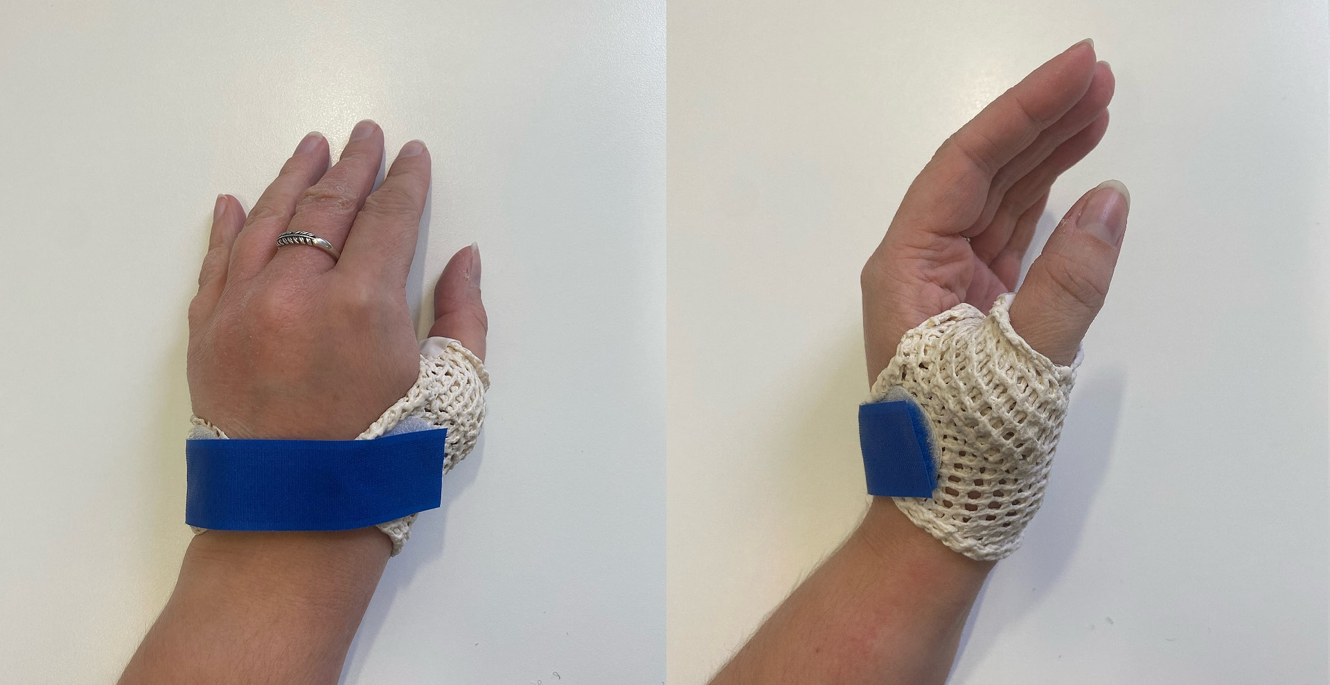 Hand and Wrist injuries from Skiing and Snowboarding - Six Physio